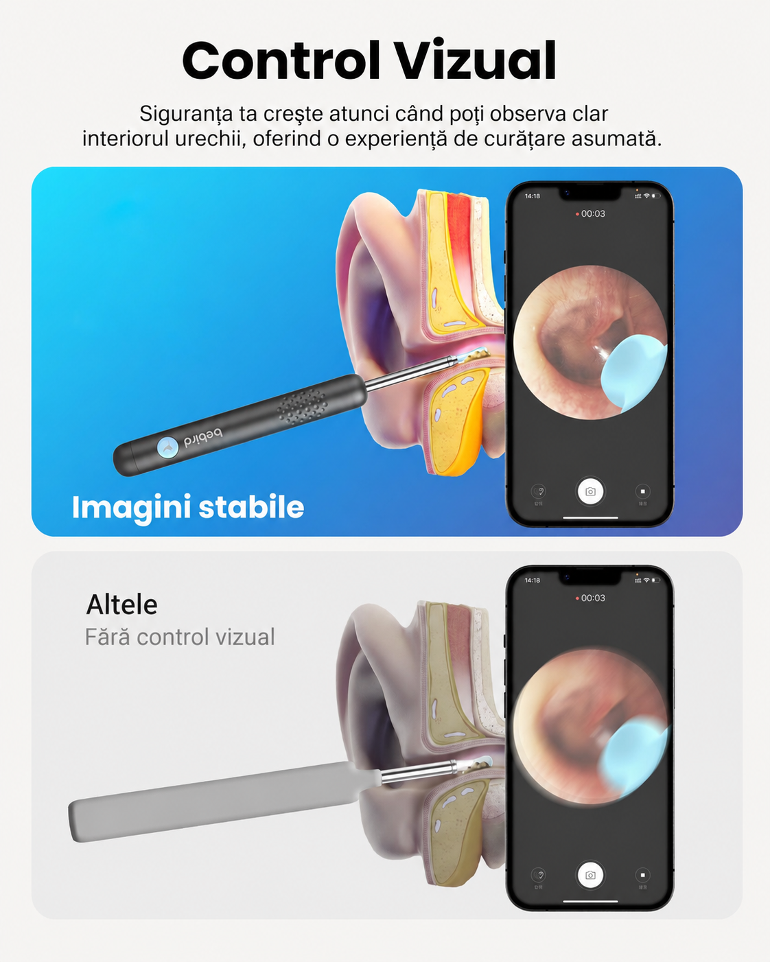 CamMicroscop pentru Urechi cu Cameră HD - Curățare Sigură și Vizualizare în Timp Real